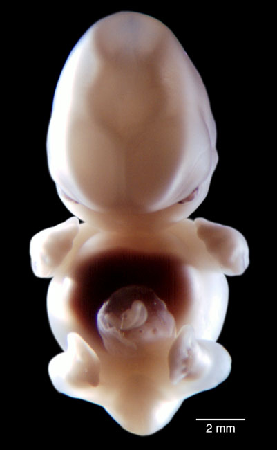 human embryo photograph