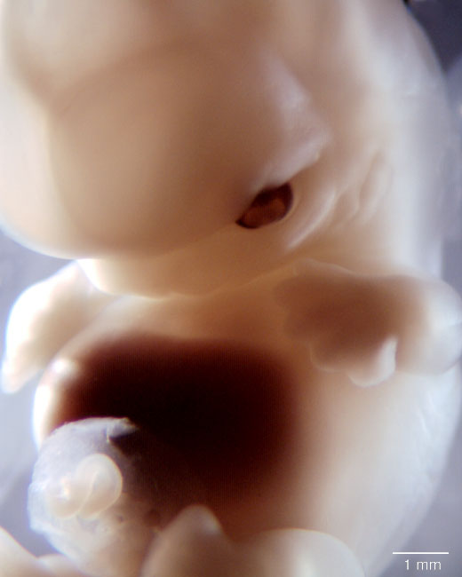 human embryo photograph