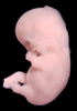 52 day human embryo photograph