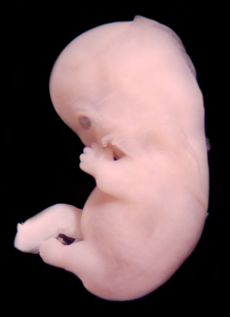 human embryo photograph