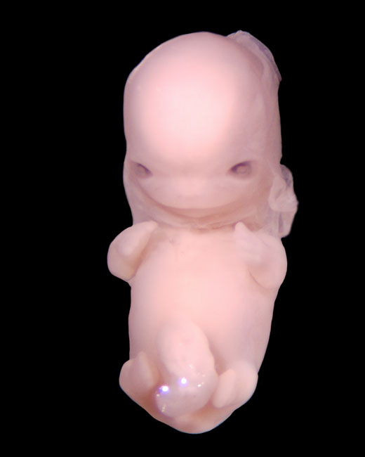 human embryo photograph