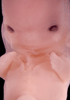 52 day human embryo photograph