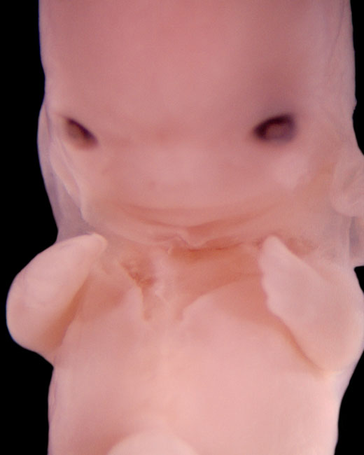 human embryo photograph