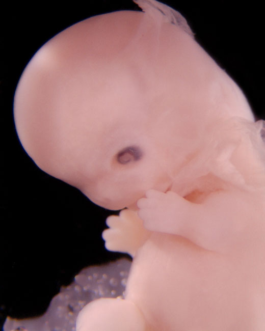 human embryo photograph