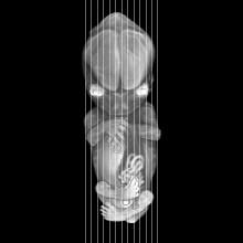 sagittal slice image map