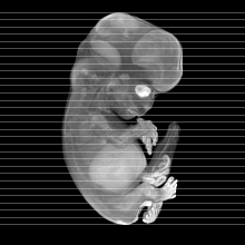 axial slice image map