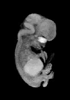 day 54 human embryo MRI animation