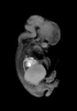 day 54 human embryo MRI animation