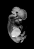 day 54 human embryo MRI animation