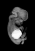 day 54 human embryo MRI animation