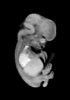 day 54 human embryo MRI animation