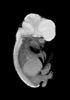 day 54 human embryo MRI animation