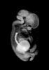 day 54 human embryo MRI animation