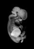 day 54 human embryo MRI animation