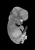 day 54 human embryo MRI animation