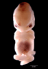 day 54 human embryo photograph