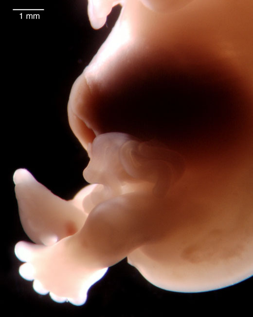 human embryo photograph