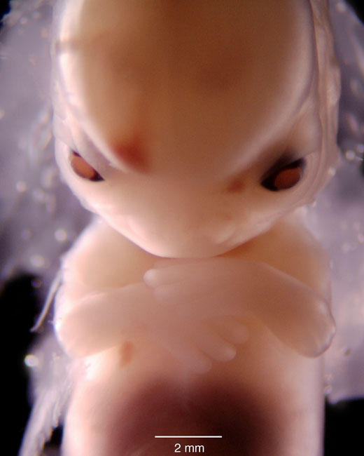 human embryo photograph