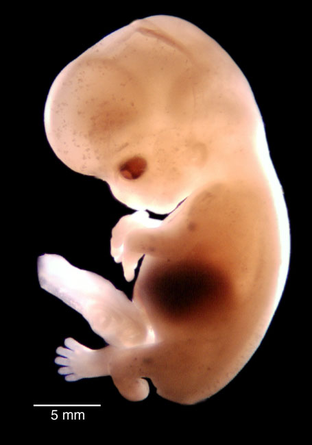 human embryo photograph