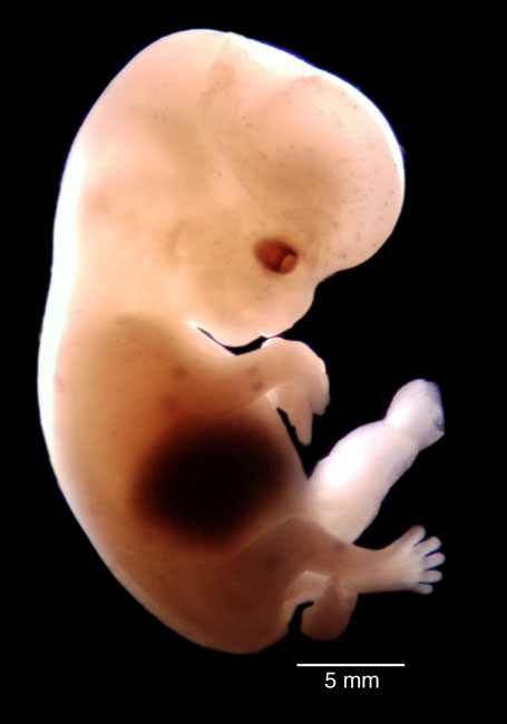 human embryo photograph