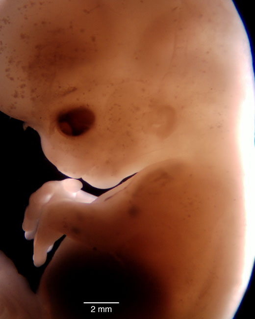 human embryo photograph