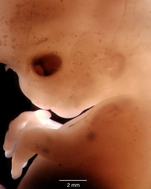 human embryo photograph