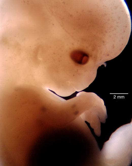 human embryo photograph