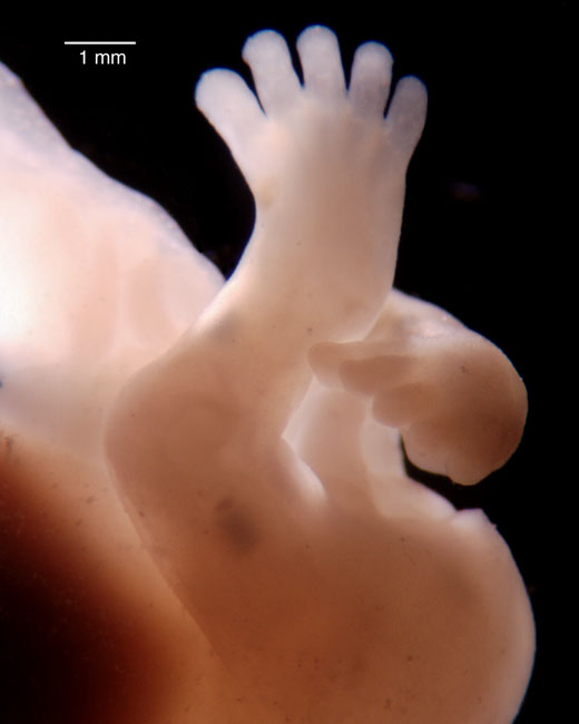 human embryo photograph