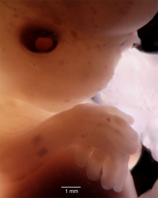 human embryo photograph