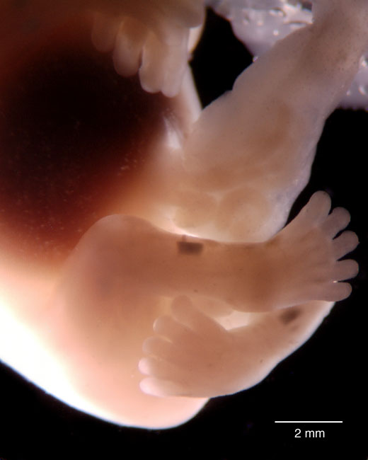 human embryo photograph