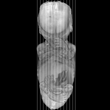 sagittal slice image map