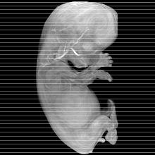 axial slice image map