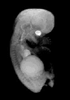 day 56 human embryo MRI animation