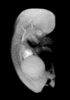 day 56 human embryo MRI animation