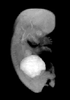 day 56 human embryo MRI animation