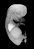 day 56 human embryo MRI animation