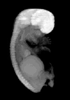 day 56 human embryo MRI animation