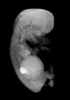 day 56 human embryo MRI animation