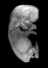 day 56 human embryo MRI animation