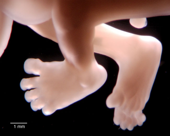 human embryo photograph