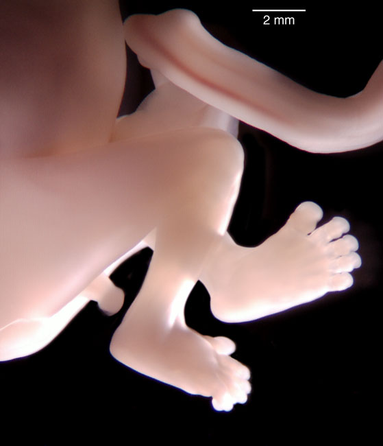 human embryo photograph