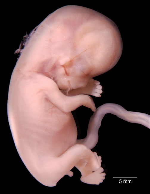 human embryo photograph