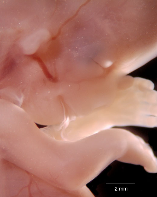 human embryo photograph