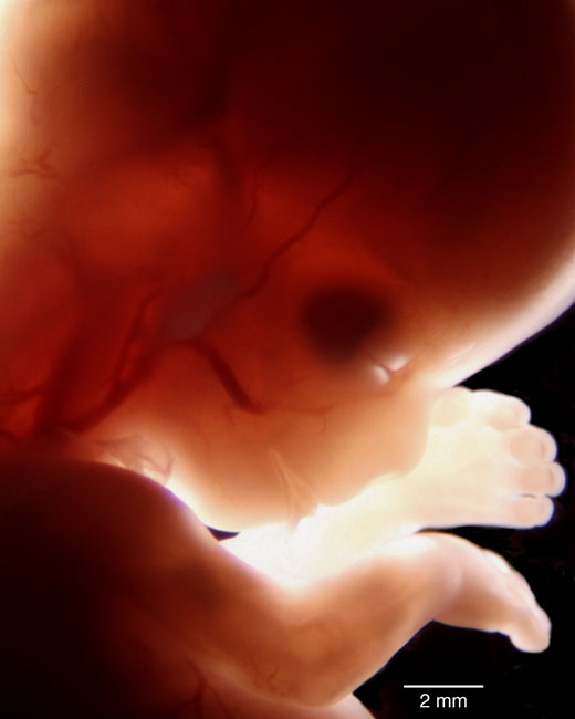 human embryo photograph