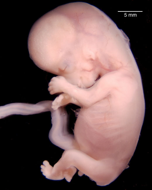 human embryo photograph