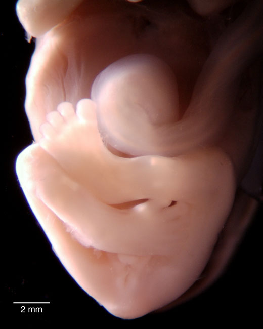 human embryo photograph