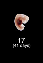 Stage 17 Embryo Image